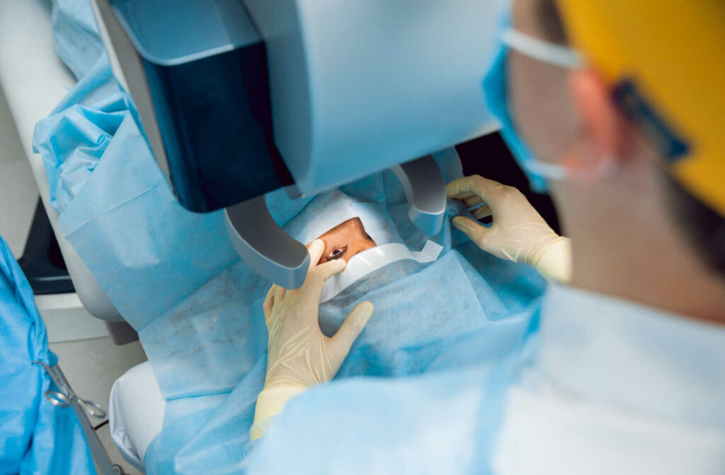 A birds eye view of a patient undergoing cataract surgery